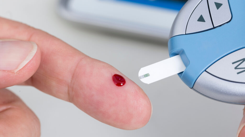 How Often Should You Check Your Blood Sugar