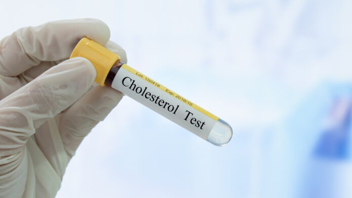 How to Cheat a Cholesterol Test